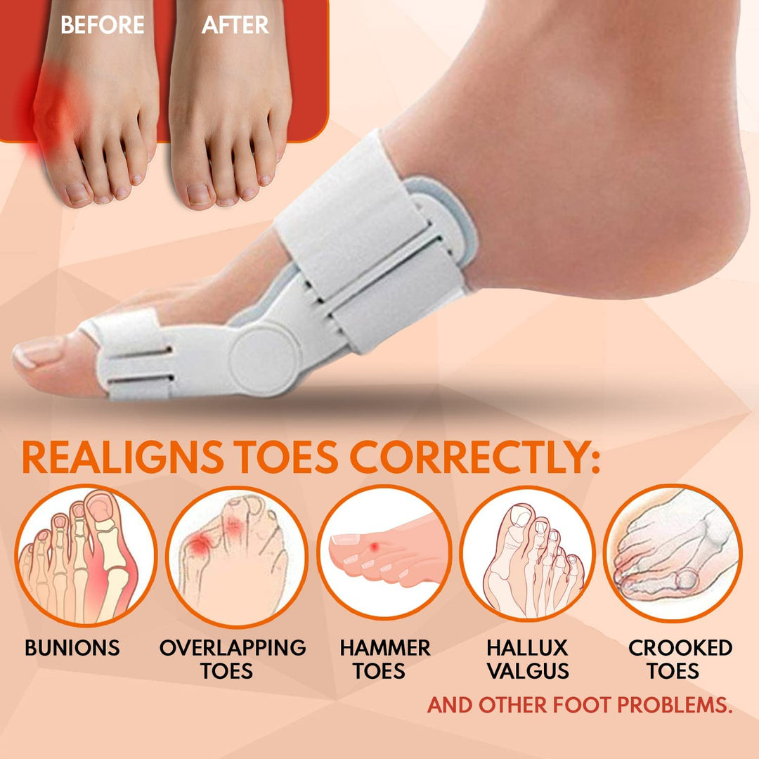 (Free Home Delivery) Pain Relief Bunion Toe Corrector