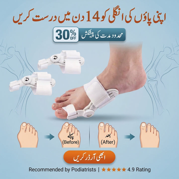 (Free Home Delivery) Pain Relief Bunion Toe Corrector